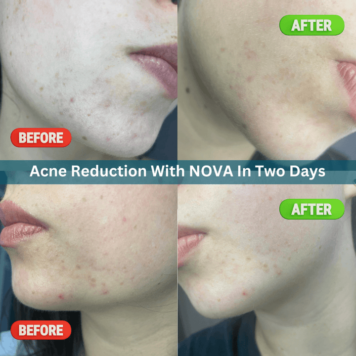 Nova Rejuvenation Starter Kit