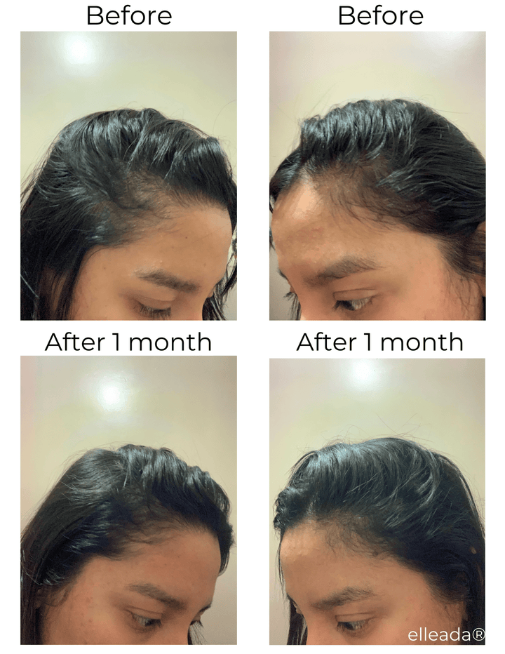 Hair Strengthening Serum - All Natural, Vegan, Hair loss, Dry/Itchy Scalp