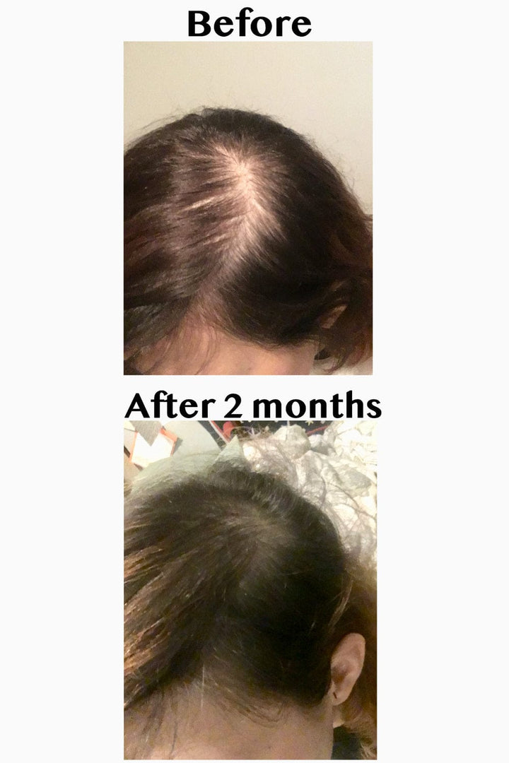Elleada Vegan Hair Strengthening Serum – Natural Relief for Hair Loss & Itchy Scalp
