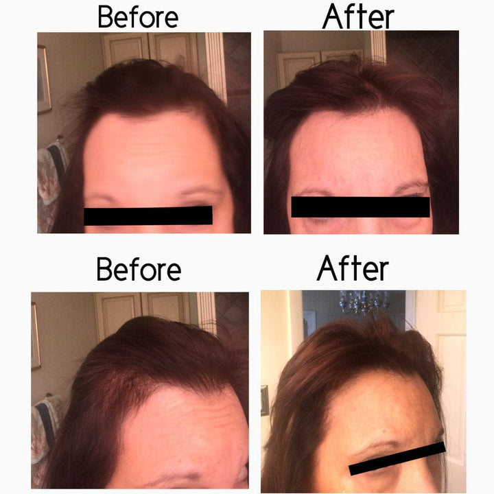 Elleada Vegan Hair Strengthening Serum – Natural Relief for Hair Loss & Itchy Scalp