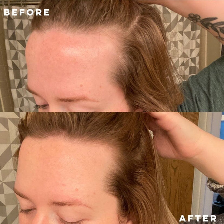 Elleada Vegan Hair Strengthening Serum – Natural Relief for Hair Loss & Itchy Scalp