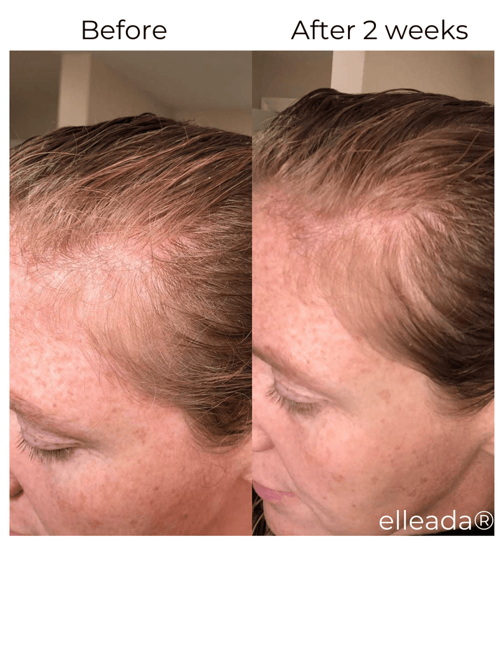 Elleada Vegan Hair Strengthening Serum – Natural Relief for Hair Loss & Itchy Scalp