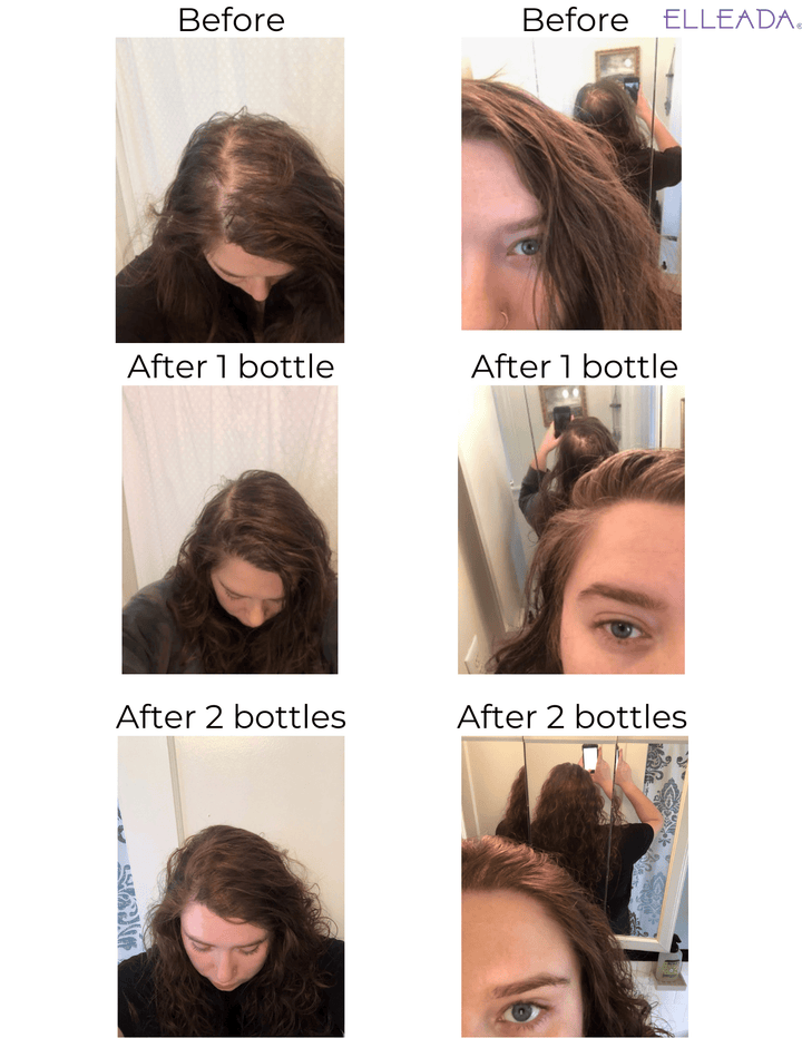 Elleada Vegan Hair Strengthening Serum – Natural Relief for Hair Loss & Itchy Scalp