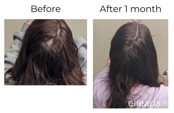 Elleada Vegan Hair Strengthening Serum – Natural Relief for Hair Loss & Itchy Scalp