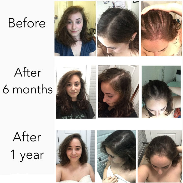 Elleada Vegan Hair Strengthening Serum – Natural Relief for Hair Loss & Itchy Scalp