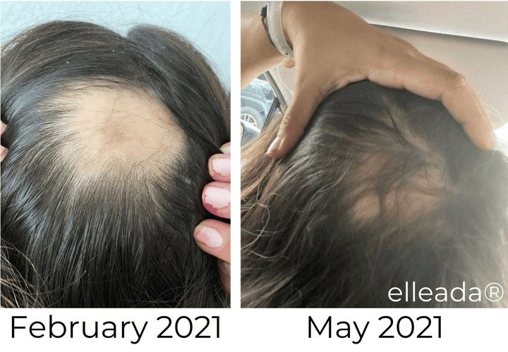 Elleada Vegan Hair Strengthening Serum – Natural Relief for Hair Loss & Itchy Scalp