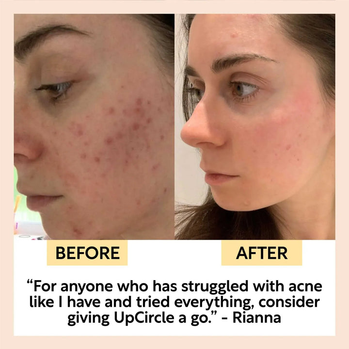 UpCircle Cleanse, Tone + Moisturize Set
