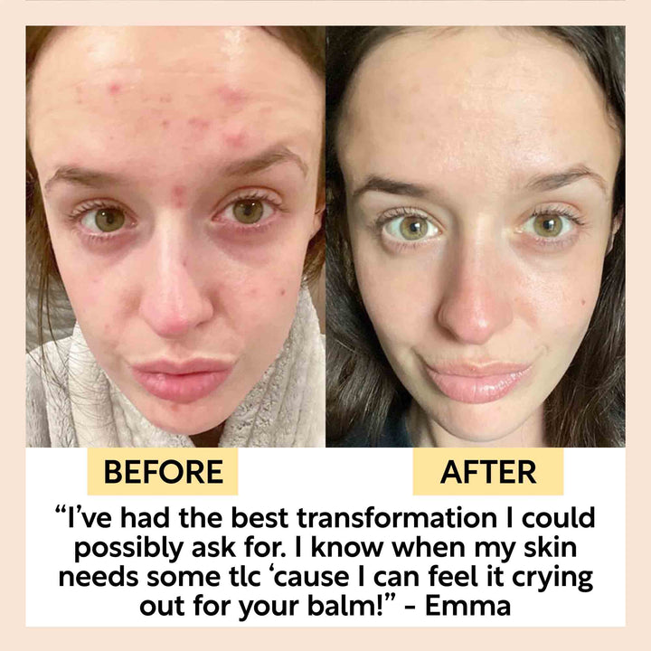 UpCircle Cleansing Face Balm