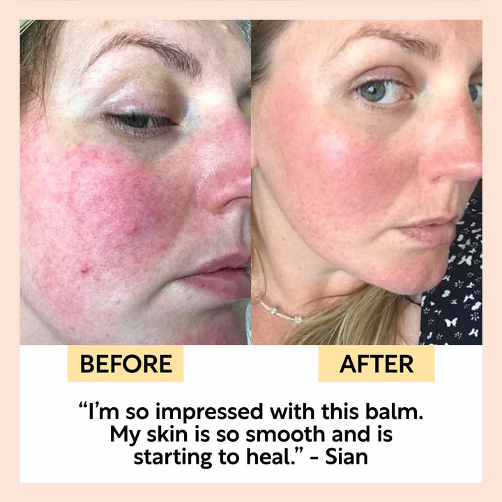 UpCircle Cleansing Face Balm