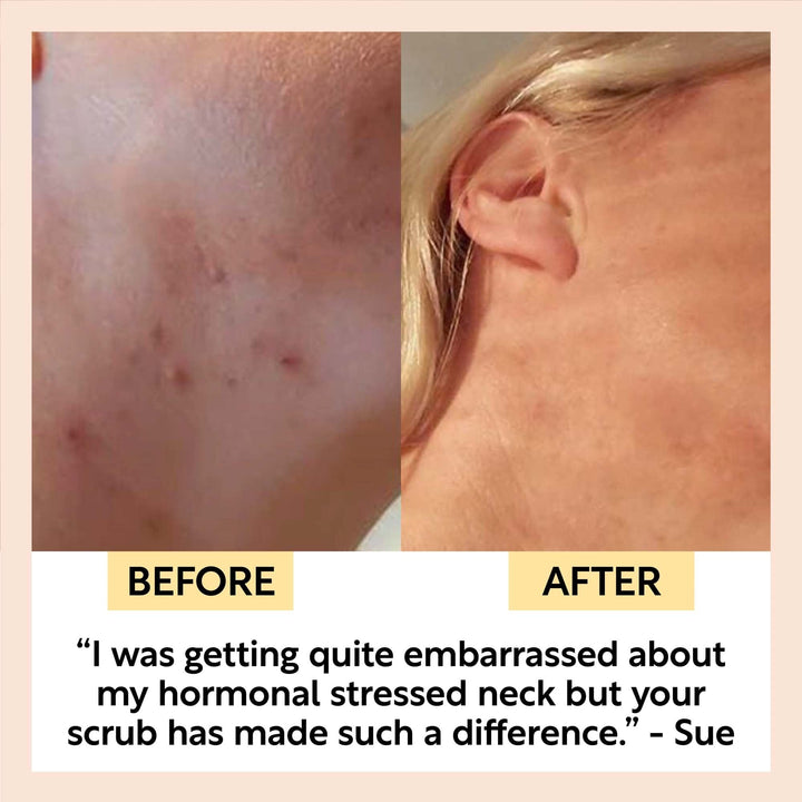 UpCircle Coffee Face Scrub