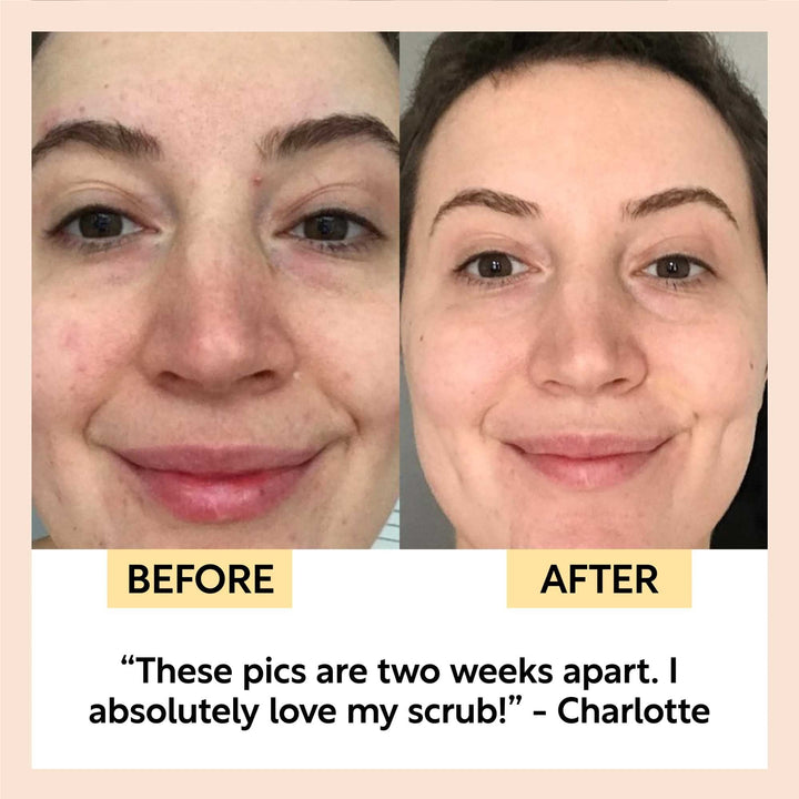 UpCircle Coffee Face Scrub