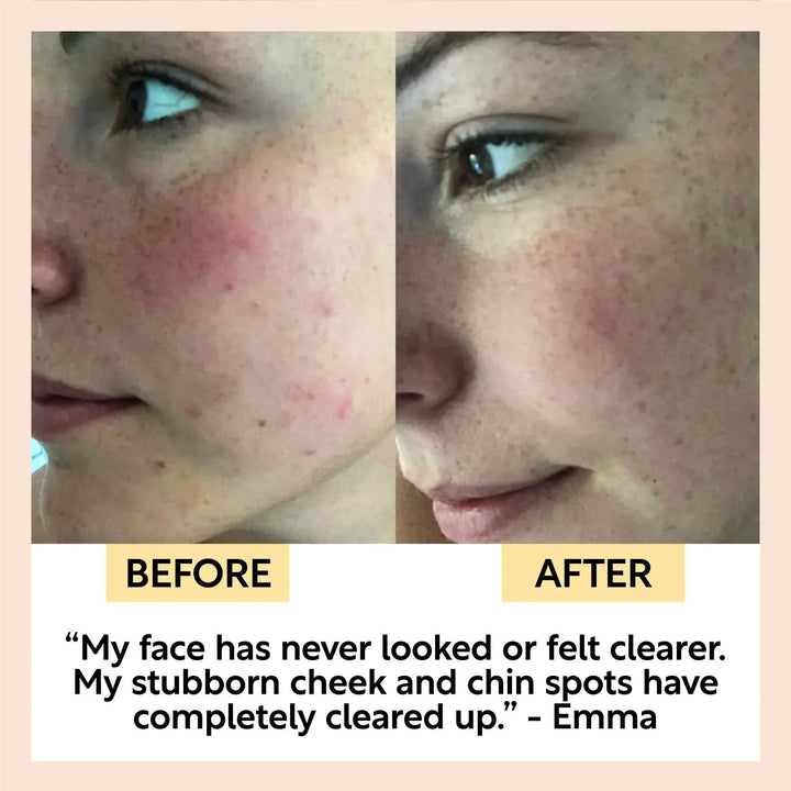 UpCircle Fennel + Cardamom Chai Cleansing Bar