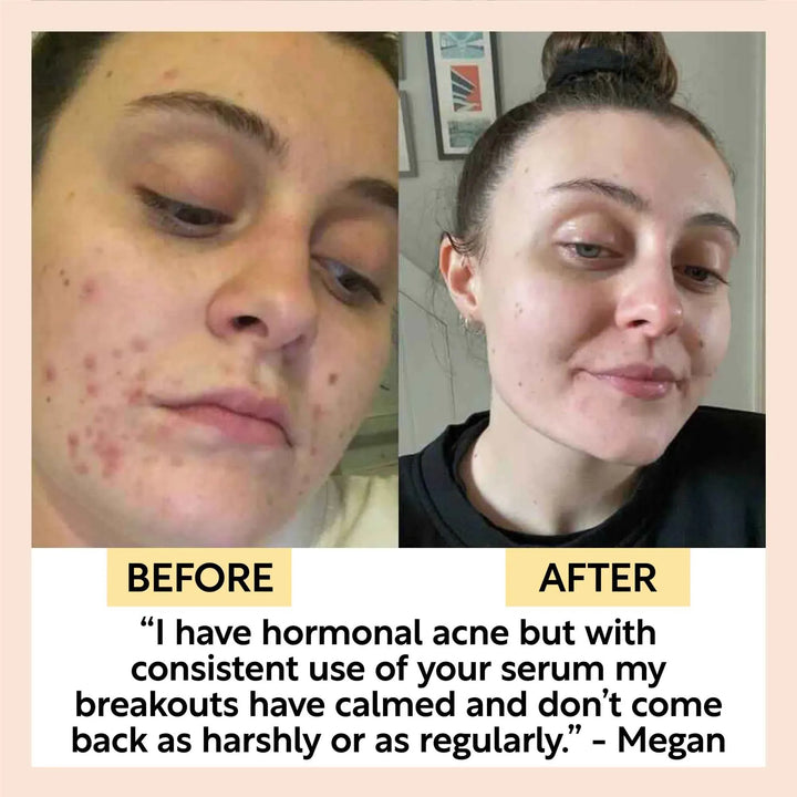 UpCircle Hydrating Face Oil with Coffee Oil - Jumbo