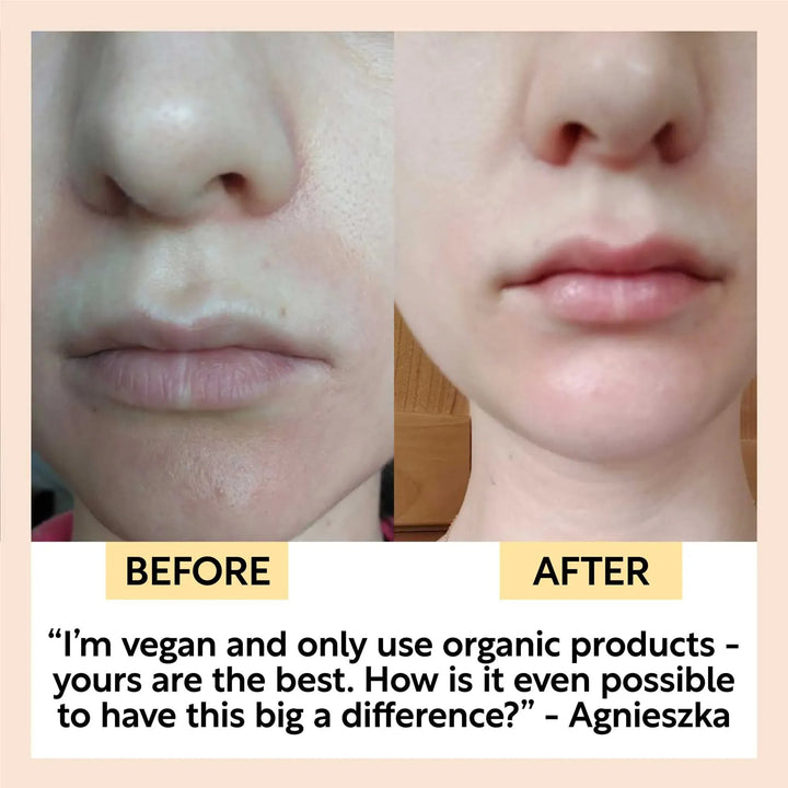 UpCircle Hydration Skincare Set