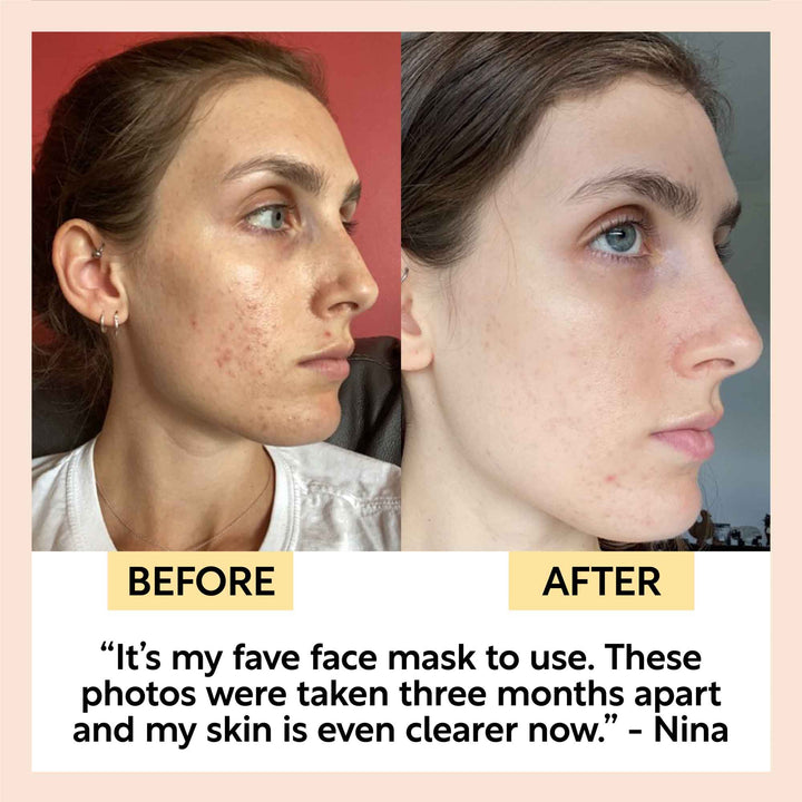 UpCircle Kaolin Clay Face Mask