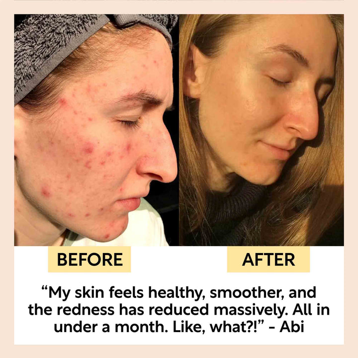 UpCircle Kaolin Clay Face Mask