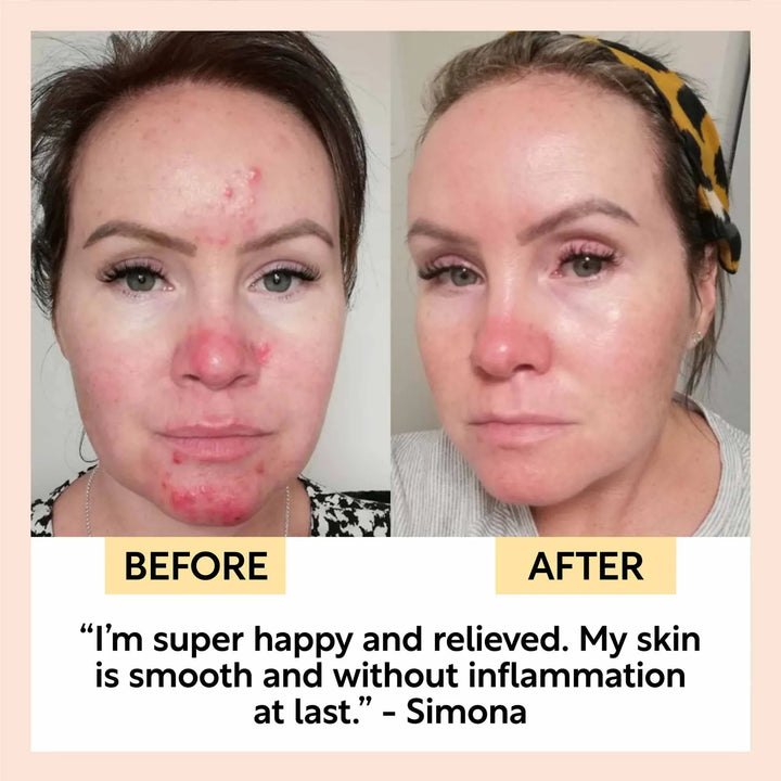 UpCircle The Sensitive Skin Bundle