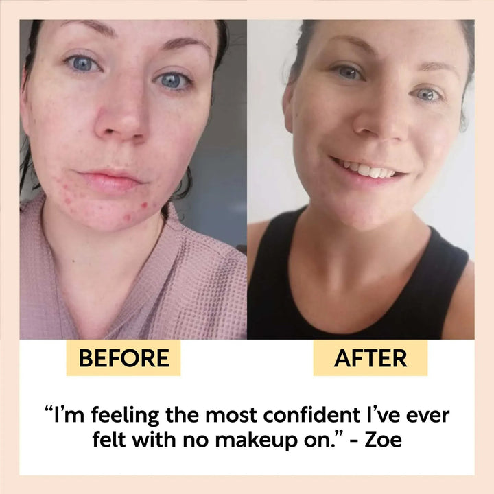 UpCircle Travel-Size Skincare Bundle